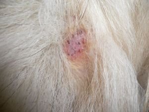 治疗牛皮癣的正确方法有哪些