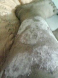 银屑病患者需要注意什么?